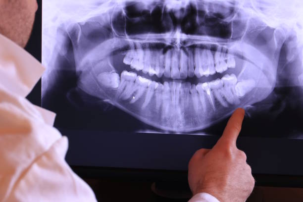 Best Emergency Tooth Extraction in Manor, TX