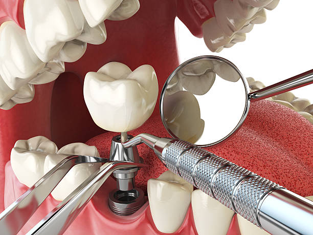 Best Emergency Gum Treatment in Manor, TX